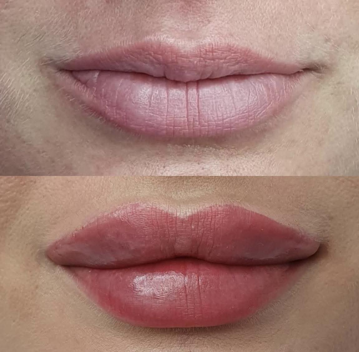 Modelowanie ust przed i po – Hello Beauty Kołobrzeg