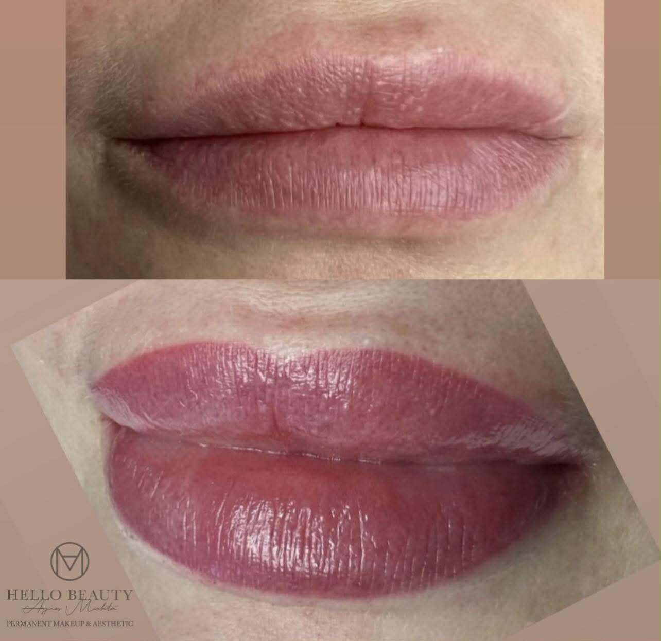 Usta permanentne bezpośrednio po zabiegu – transformacja Hello Beauty