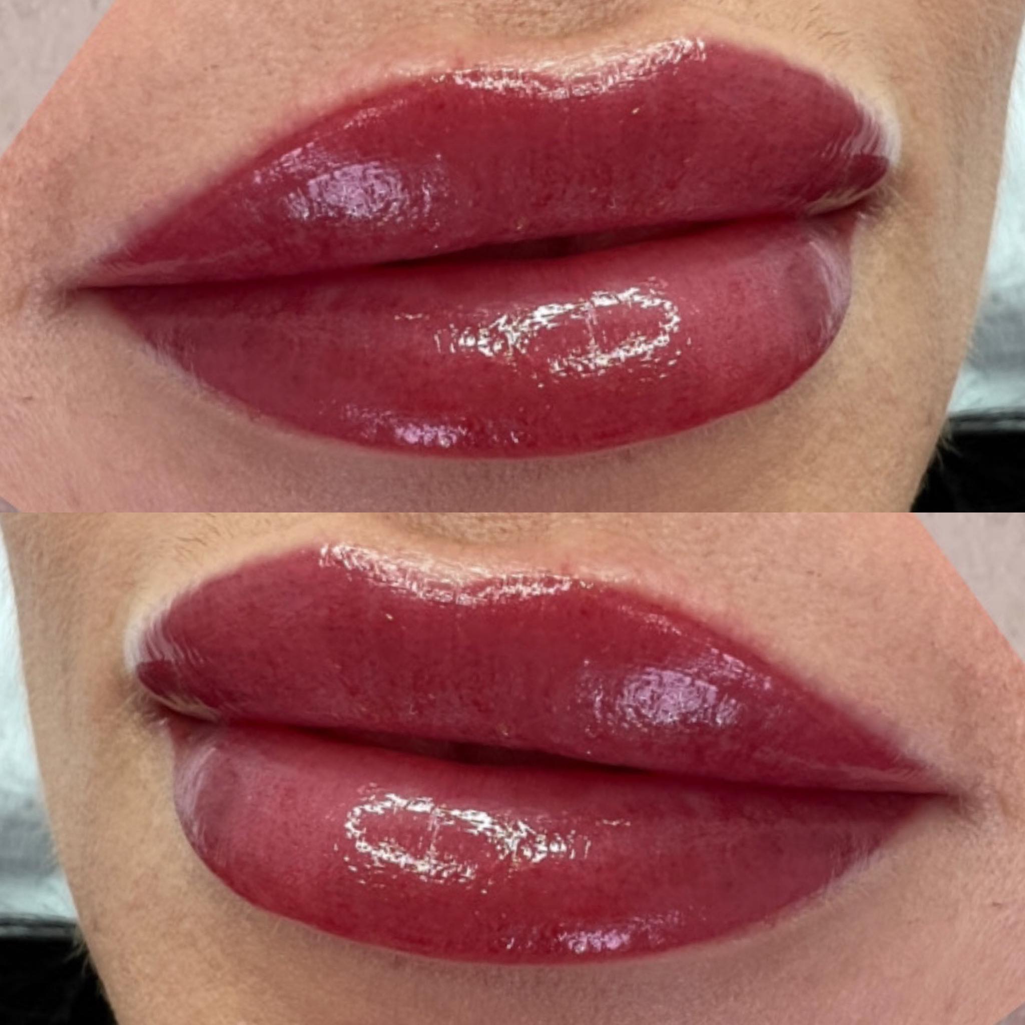 Usta permanentne – realizacja 4