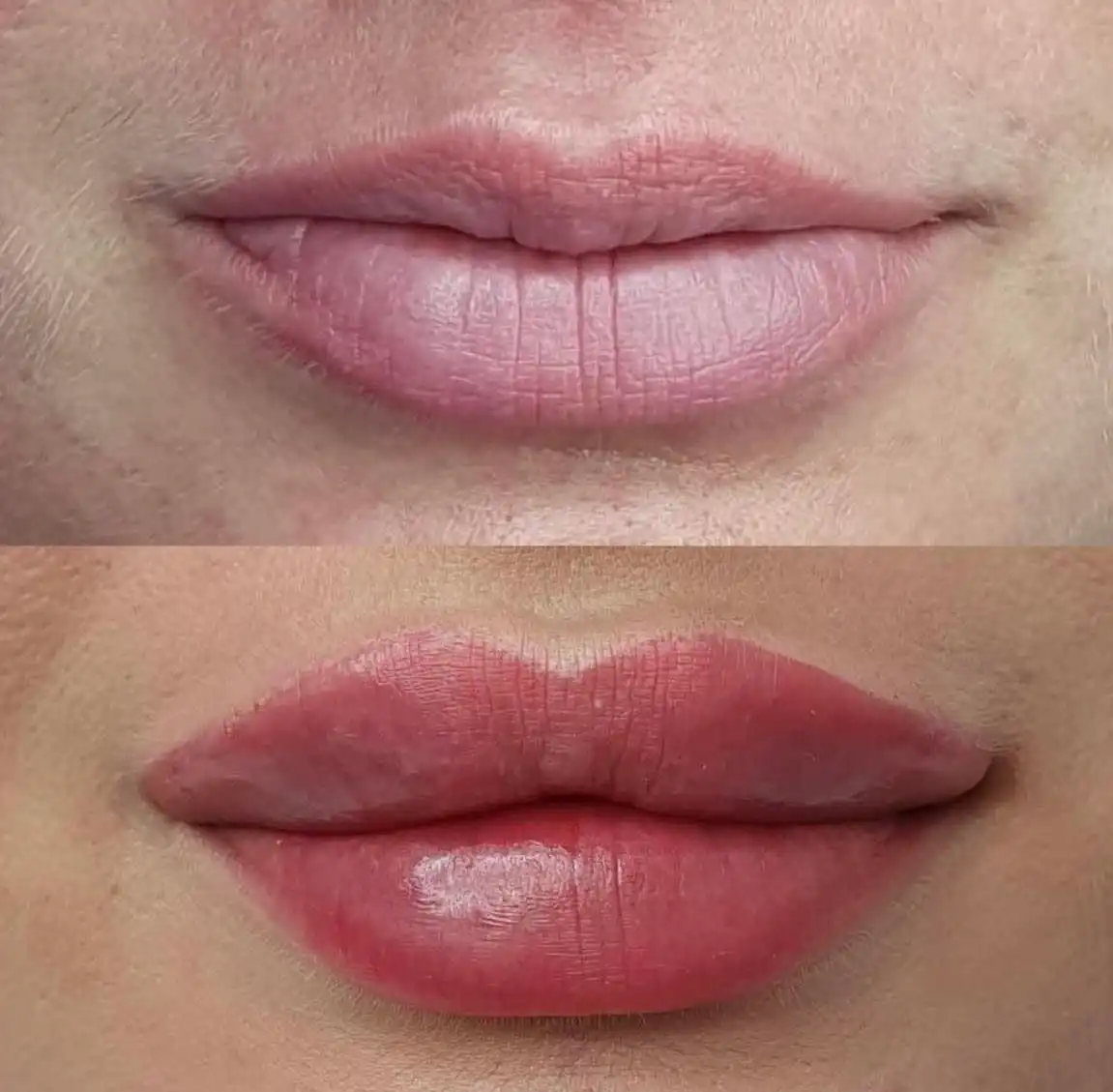 Modelowanie ust przed i po – Hello Beauty Kołobrzeg